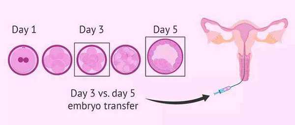 剖腹产做试管生二胎可以放两个囊胚吗？