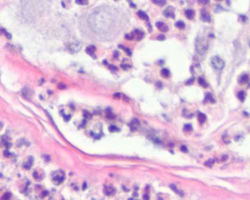 2026广州试管代怀孕价格行情与供卵代怀公司介绍