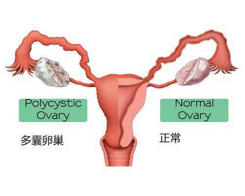 三代试管婴儿准备与实施指南