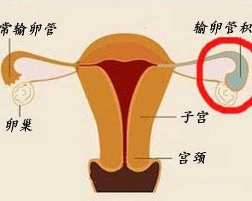 国内权威供卵试管医院全面解析与费用指南