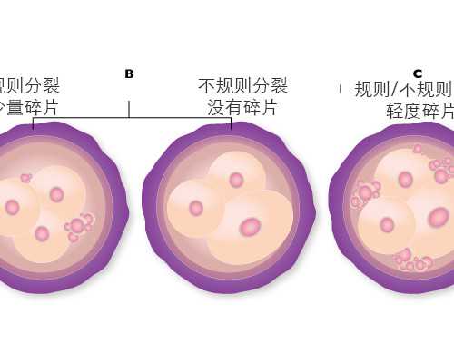 广州越秀天伦试管机构地址及供卵中心位置导航