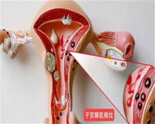 厦门单身女性必看—人工授精医学真相与供卵助孕指南