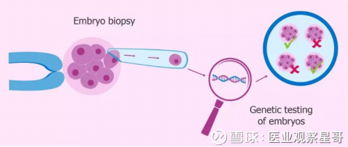 厦门供卵助孕指南·少精试管成功核心解析